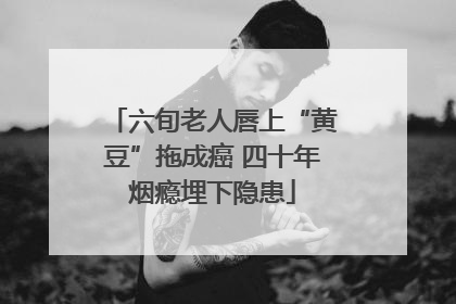 六旬老人唇上“黄豆”拖成癌 四十年烟瘾埋下隐患